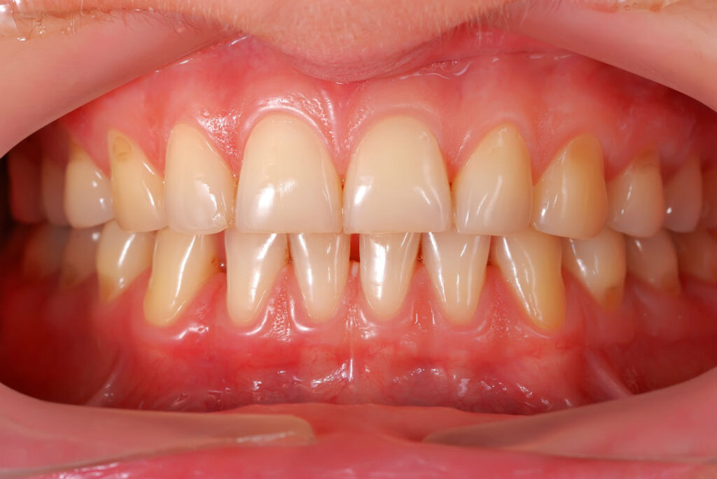 closeup image of a healthy teeth